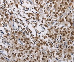 Invitrogen CMTM2 Polyclonal Antibody 100 &mu;L | Buy Online | Invitrogen&trade; | Fisher Scientific