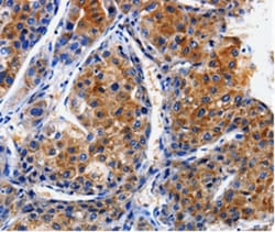 CLCA4 Polyclonal Antibody, Invitrogen 100 &mu;L; Unconjugated:Antibodies,