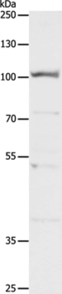 Invitrogen CLCA4 Polyclonal Antibody 100 &mu;L; Unconjugated:Antibodies,
