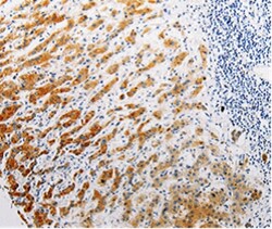 CLEC1B Polyclonal Antibody:Antibodies, Polyclonal