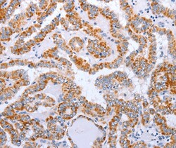 Invitrogen DTX2 Polyclonal Antibody 100 &mu;L; Unconjugated:Antibodies,