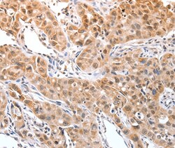 Invitrogen DPPA2 Polyclonal Antibody 100 &mu;L | Buy Online | Invitrogen&trade; | Fisher Scientific