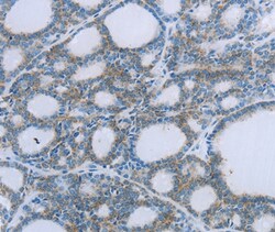 Invitrogen EGFL7 Polyclonal Antibody 100 &mu;L; Unconjugated:Antibodies,