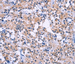 Invitrogen DUSP22 Polyclonal Antibody 100 &mu;L; Unconjugated:Antibodies,