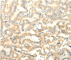 Invitrogen FOXR2 Polyclonal Antibody 100 &mu;L; Unconjugated:Antibodies,
