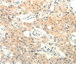 Invitrogen FOXR2 Polyclonal Antibody 100 &mu;L; Unconjugated:Antibodies,