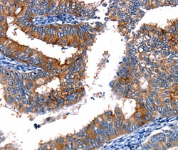 Invitrogen TBX22 Polyclonal Antibody 100 &mu;L; Unconjugated:Antibodies,