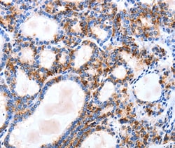 Invitrogen IGSF6 Polyclonal Antibody 100 &mu;L; Unconjugated:Antibodies,