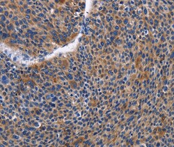 Invitrogen IGSF10 Polyclonal Antibody 100 &mu;L; Unconjugated:Antibodies,