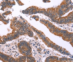 Invitrogen IRAK1BP1 Polyclonal Antibody 100 &mu;L; Unconjugated:Antibodies,