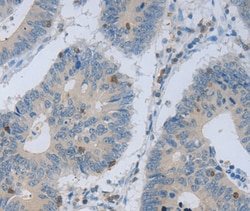 Invitrogen MAGEB4 Polyclonal Antibody 100 &mu;L; Unconjugated:Antibodies,