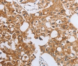 Invitrogen MUC20 Polyclonal Antibody 100 &mu;L; Unconjugated:Antibodies,