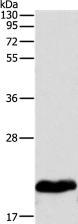 Invitrogen MYL2 Polyclonal Antibody 100 &mu;L; Unconjugated:Antibodies,