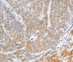 Invitrogen NTS Polyclonal Antibody 100 &mu;L; Unconjugated:Antibodies,