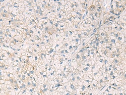 Invitrogen OAS2 Polyclonal Antibody 100 &mu;L; Unconjugated:Antibodies,