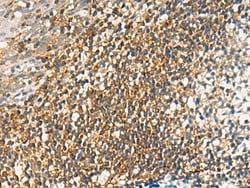 Invitrogen OAS2 Polyclonal Antibody 100 &mu;L; Unconjugated:Antibodies,