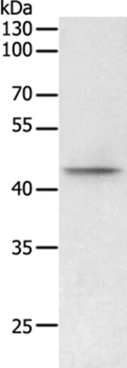 Invitrogen PHF6 Polyclonal Antibody 100 &mu;L | Buy Online | Invitrogen&trade; | Fisher Scientific