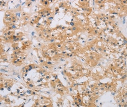 Invitrogen RAD54L2 Polyclonal Antibody 100 &mu;L; Unconjugated:Antibodies,