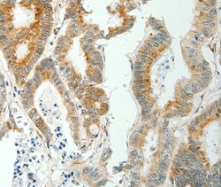 Invitrogen SELM Polyclonal Antibody 100 &mu;L; Unconjugated:Antibodies,