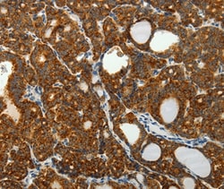 Invitrogen SELM Polyclonal Antibody 100 &mu;L; Unconjugated:Antibodies,