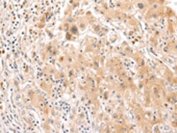 Invitrogen SOCS6 Polyclonal Antibody 100 &mu;L; Unconjugated:Antibodies,