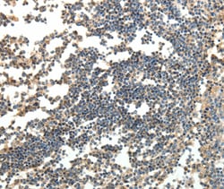 Invitrogen SPAG8 Polyclonal Antibody 100 &mu;L; Unconjugated:Antibodies,