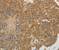 Invitrogen SULT1E1 Polyclonal Antibody 100 &mu;L | Buy Online | Invitrogen&trade; | Fisher Scientific