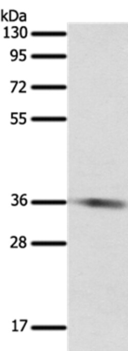 Invitrogen SULT1E1 Polyclonal Antibody 100 &mu;L | Buy Online | Invitrogen&trade; | Fisher Scientific
