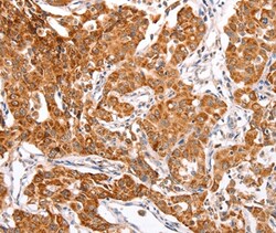 Invitrogen TRAF5 Polyclonal Antibody 100 &mu;L | Buy Online | Invitrogen&trade; | Fisher Scientific