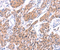 Invitrogen Unc18-2 Polyclonal Antibody 100 &mu;L; Unconjugated:Antibodies,