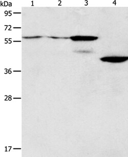 Invitrogen PGBD2 Polyclonal Antibody 100 &mu;L; Unconjugated:Anticuerpos