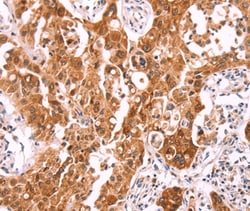 Invitrogen NCEH1 Polyclonal Antibody 100 &mu;L; Unconjugated:Antibodies,