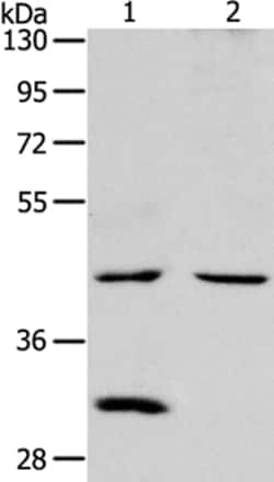 Invitrogen NCEH1 Polyclonal Antibody 100 &mu;L; Unconjugated:Antibodies,