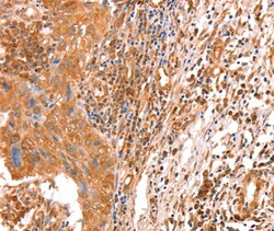 Invitrogen ACAD9 Polyclonal Antibody 100 &mu;L; Unconjugated:Antibodies,