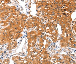 Invitrogen ACSBG1 Polyclonal Antibody 100 &mu;L; Unconjugated:Antibodies,