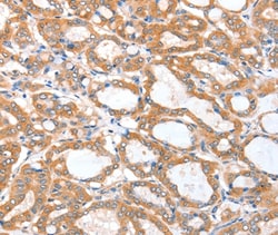 Invitrogen ACSBG1 Polyclonal Antibody 100 &mu;L; Unconjugated:Antibodies,