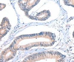 Invitrogen FHL5 Polyclonal Antibody 100 &mu;L; Unconjugated:Antibodies,