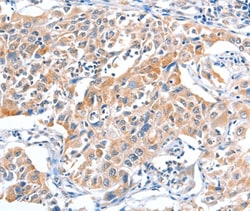 Invitrogen FHL5 Polyclonal Antibody 100 &mu;L; Unconjugated:Antibodies,