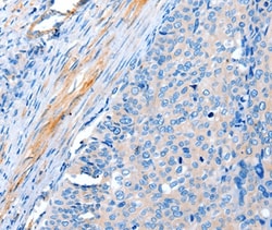Invitrogen ACTRT1 Polyclonal Antibody 100 &mu;L; Unconjugated:Antibodies,