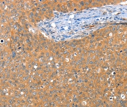 Invitrogen ACY3 Polyclonal Antibody 100 &mu;L; Unconjugated:Antibodies,