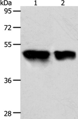 Invitrogen ACOT9 Polyclonal Antibody 100 &mu;L; Unconjugated:Antibodies,