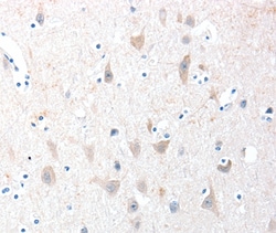 Invitrogen ADAM20 Polyclonal Antibody 100 &mu;L | Buy Online | Invitrogen&trade; | Fisher Scientific