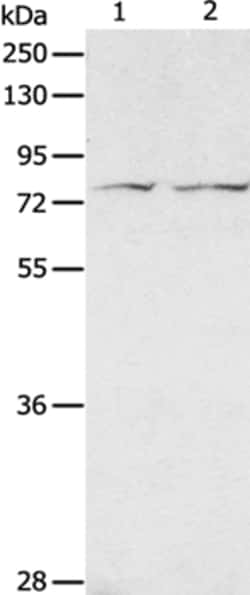 Invitrogen ADAM20 Polyclonal Antibody 100 &mu;L | Buy Online | Invitrogen&trade; | Fisher Scientific