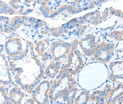 Invitrogen ADAM21 Polyclonal Antibody 100 &mu;L; Unconjugated:Antibodies,