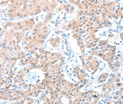 Invitrogen ADAM21 Polyclonal Antibody 100 &mu;L; Unconjugated:Antibodies,