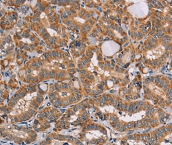 Invitrogen Aladin Polyclonal Antibody 100 &mu;L; Unconjugated:Antibodies,