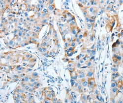 Invitrogen AGA Polyclonal Antibody 100 &mu;L; Unconjugated:Antibodies,