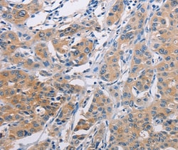 Invitrogen&trade;&nbsp;AGBL5 Polyclonal Antibody