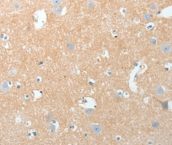 Invitrogen AKAP7 Polyclonal Antibody 100 &mu;L; Unconjugated:Antibodies,