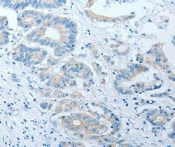 Invitrogen AKAP7 Polyclonal Antibody 100 &mu;L; Unconjugated:Antibodies,
